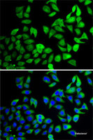 Immunofluorescence analysis of A-549 cells using USP8 Polyclonal Antibody