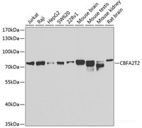 Western blot analysis of extracts of various cell lines using CBFA2T2 Polyclonal Antibody at dilution of 1:1000.