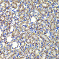 Immunohistochemistry of paraffin-embedded Rat kidney using COPS2 Polyclonal Antibody at dilution of 1:100 (40x lens) .