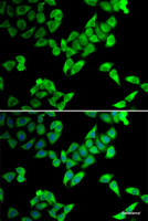 Immunofluorescence analysis of U2OS cells using TRIP10 Polyclonal Antibody