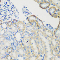 Immunohistochemistry of paraffin-embedded Rat kidney using TGM5 Polyclonal Antibody at dilution of 1:200 (40x lens) .