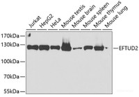 Western blot analysis of extracts of various cell lines using EFTUD2 Polyclonal Antibody at dilution of 1:2000.