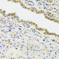 Immunohistochemistry of paraffin-embedded Rat liver using EFTUD2 Polyclonal Antibody at dilution of 1:100 (40x lens) .