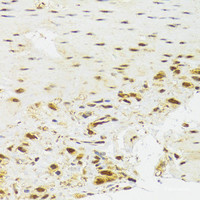 Immunohistochemistry of paraffin-embedded Human stomach using EFTUD2 Polyclonal Antibody at dilution of 1:100 (40x lens) .