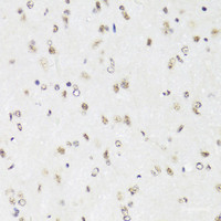 Immunohistochemistry of paraffin-embedded Mouse brain using EFTUD2 Polyclonal Antibody at dilution of 1:100 (40x lens) .