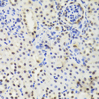 Immunohistochemistry of paraffin-embedded Mouse kidney using EFTUD2 Polyclonal Antibody at dilution of 1:100 (40x lens) .