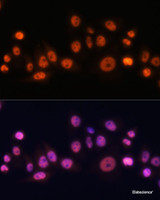 Immunofluorescence analysis of HeLa cells using EFTUD2 Polyclonal Antibody at dilution of 1:100. Blue: DAPI for nuclear staining.