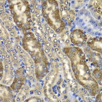 Immunohistochemistry of paraffin-embedded Mouse kidney using NMT2 Polyclonal Antibody at dilution of 1:100 (40x lens) .