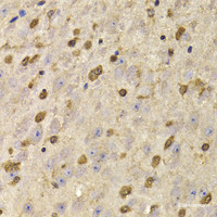 Immunohistochemistry of paraffin-embedded Mouse brain using QKI Polyclonal Antibody at dilution of 1:100 (40x lens) .