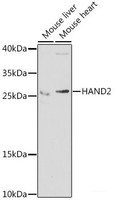 Western blot analysis of extracts of various cell lines using HAND2 Polyclonal Antibody at dilution of 1:1000.