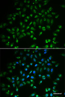 Immunofluorescence analysis of A549 cells using HAND2 Polyclonal Antibody