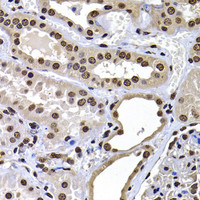 Immunohistochemistry of paraffin-embedded Human kidney using mH2A1 Polyclonal Antibody at dilution of 1:100 (40x lens) .