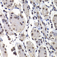 Immunohistochemistry of paraffin-embedded Human stomach using mH2A1 Polyclonal Antibody at dilution of 1:100 (40x lens) .