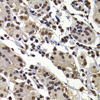 Immunohistochemistry of paraffin-embedded Human stomach using DNAJB6 Polyclonal Antibody at dilution of 1:100 (40x lens) .