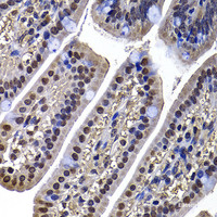 Immunohistochemistry of paraffin-embedded Mouse ileum using DNAJB6 Polyclonal Antibody at dilution of 1:100 (40x lens) .