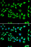 Immunofluorescence analysis of U2OS cells using DNAJB6 Polyclonal Antibody