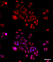 Immunofluorescence analysis of HeLa cells using DNAJB6 Polyclonal Antibody at dilution of 1:100 (40x lens) . Blue: DAPI for nuclear staining.