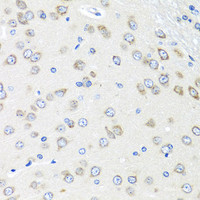 Immunohistochemistry of paraffin-embedded Rat brain using PIAS3 Polyclonal Antibody at dilution of 1:100 (40x lens) .