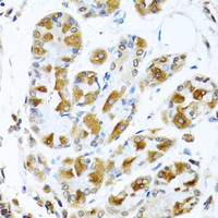 Immunohistochemistry of paraffin-embedded Human stomach using PIAS3 Polyclonal Antibody at dilution of 1:100 (40x lens) .