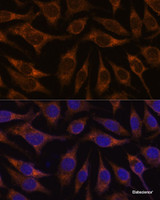 Immunofluorescence analysis of L929 cells using AGR2 Polyclonal Antibody at dilution of 1:100. Blue: DAPI for nuclear staining.