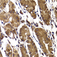 Immunohistochemistry of paraffin-embedded Human stomach using STAMBP Polyclonal Antibody at dilution of 1:100 (40x lens) .