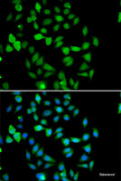 Immunofluorescence analysis of U2OS cells using STAMBP Polyclonal Antibody