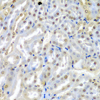 Immunohistochemistry of paraffin-embedded Mouse kidney using TUSC2 Polyclonal Antibody at dilution of 1:200 (40x lens) .
