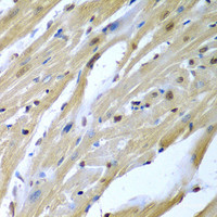 Immunohistochemistry of paraffin-embedded Mouse heart using TUSC2 Polyclonal Antibody at dilution of 1:200 (40x lens) .
