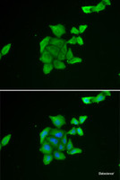 Immunofluorescence analysis of U2OS cells using TUSC2 Polyclonal Antibody