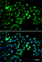 Immunofluorescence analysis of A549 cells using MTF2 Polyclonal Antibody