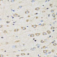 Immunohistochemistry of paraffin-embedded Rat brain using CLIC4 Polyclonal Antibody at dilution of 1:100 (40x lens) .