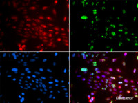 Immunofluorescence analysis of GFP-RNF168 transgenic U2OS cells using L3MBTL1 Polyclonal Antibody