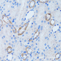 Immunohistochemistry of paraffin-embedded Rat kidney using LDLRAP1 Polyclonal Antibody at dilution of 1:100 (40x lens) .