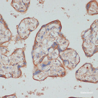 Immunohistochemistry of paraffin-embedded Human placenta using TES Polyclonal Antibody at dilution of 1:100 (40x lens) .