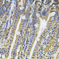 Immunohistochemistry of paraffin-embedded Mouse intestine using NFU1 Polyclonal Antibody at dilution of 1:100 (40x lens) .