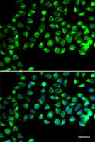 Immunofluorescence analysis of A549 cells using C16orf80 Polyclonal Antibody