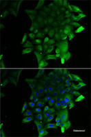 Immunofluorescence analysis of U2OS cells using SEPSECS Polyclonal Antibody