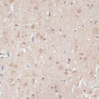 Immunohistochemistry of paraffin-embedded Rat brain using NAA20 Polyclonal Antibody at dilution of 1:100 (40x lens) .