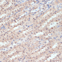 Immunohistochemistry of paraffin-embedded Rat kidney using NAA20 Polyclonal Antibody at dilution of 1:100 (40x lens) .