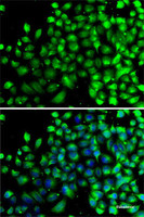 Immunofluorescence analysis of A-549 cells using NAA20 Polyclonal Antibody