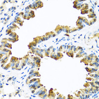 Immunohistochemistry of paraffin-embedded Mouse lung using SERPINA10 Polyclonal Antibody at dilution of 1:100 (40x lens) .