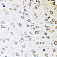 Immunohistochemistry of paraffin-embedded Mouse brain using SERPINA10 Polyclonal Antibody at dilution of 1:100 (40x lens) .