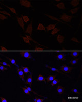 Immunofluorescence analysis of PC-12 cells using SERPINA10 Polyclonal Antibody at dilution of 1:100 (40x lens) . Blue: DAPI for nuclear staining.