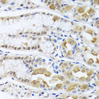 Immunohistochemistry of paraffin-embedded Human stomach using TRMT1 Polyclonal Antibody at dilution of 1:100 (40x lens) .