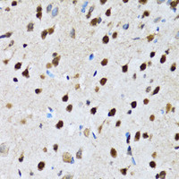Immunohistochemistry of paraffin-embedded Rat brain using CCAR2 Polyclonal Antibody at dilution of 1:100 (40x lens) .