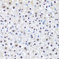 Immunohistochemistry of paraffin-embedded Mouse liver using CCAR2 Polyclonal Antibody at dilution of 1:100 (40x lens) .