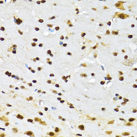 Immunohistochemistry of paraffin-embedded Mouse brain using CCAR2 Polyclonal Antibody at dilution of 1:100 (40x lens) .