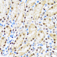 Immunohistochemistry of paraffin-embedded Mouse kidney using CCAR2 Polyclonal Antibody at dilution of 1:100 (40x lens) .