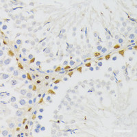 Immunohistochemistry of paraffin-embedded Rat testis using ELAC2 Polyclonal Antibody at dilution of 1:200 (40x lens) .