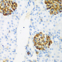 Immunohistochemistry of paraffin-embedded Rat kidney using CSRNP1 Polyclonal Antibody at dilution of 1:200 (40x lens) .